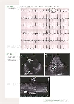 専門医のための血液病学 専門医のための血液病学 | 鈴木 隆浩, 竹中 克斗, 池添 隆之 |本